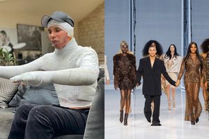 „Balmain“ dizaineris O. Rousteingas pagaliau paviešino skaudų įvykį: metus nuo visų išradingai slėpė sutvarstytą kūną