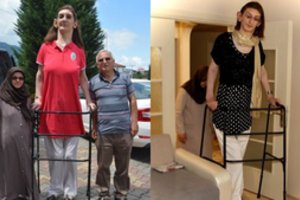 Aukščiausia pasaulio moterimi pripažinta 215,16 cm ūgio turkė