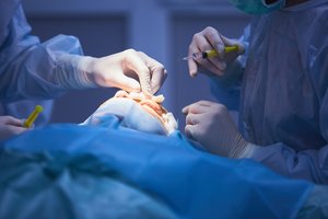 Paaiškino: štai kada akių vokų pakėlimo operacija atliekama nemokamai