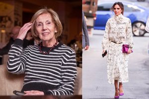 Kaip išsaugoti gražias kojas? Operacijai kadaise ryžosi ir Alma Adamkienė