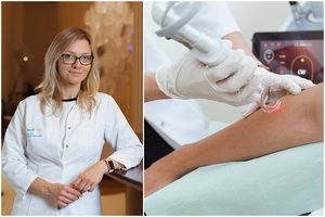 Odos senėjimas prasideda sulaukus 20 metų: kelios kūno vietos visada išduos jūsų tikrąjį amžių