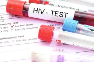 Kasdien per tūkstantį gyvybių užgesinantis koronavirusas – ne vienintelė epidemija šalyje, gąsdina ir kita mirtina infekcija