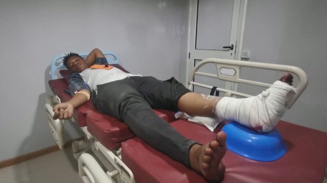 Į Sudano ligoninę suplūdo nukentėję per protestą prieš perversmą: mažiausiai trys žuvo, 80 sužeisti