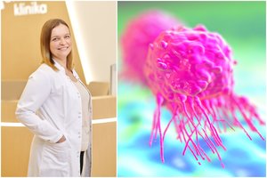 Gydytoja perspėjo moteris: savityros nepakanka – prieš vėžį geriausiai veikia kitas būdas