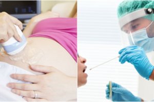 COVID-19 susirgo ir kūdikio besilaukianti kavinės savininkė: skiepytis nenorėjo