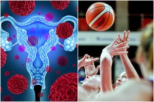 Buvusi legendinės „Kibirkšties“ krepšininkė išgirdo klastingos ligos diagnozę: nori perspėti kitas moteris