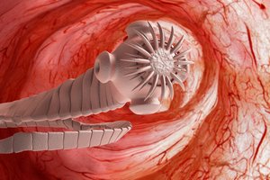 Šiurpus atvejis: iš pažiūros sveiką vyrą apėmė traukuliai, medikai smegenyse rado netikėtą svečią