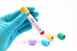 Išsklaidė vyrų baimes dėl tyrimų: patikra gali užbėgti už akių sunkioms ligoms