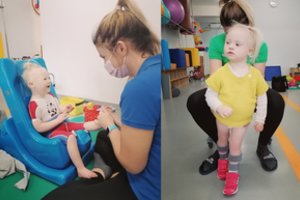 Per anksti gimusiai Emilijai kiekviena diena yra iššūkis: mergytė nevaldo kairiosios kūno pusės