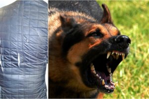 Palaidas šuo užpuolė pasivaikščioti išėjusį ugniagesį: vos apsigynęs vyras įspėja kitus