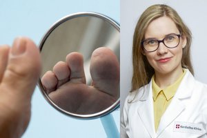 Sausa oda, tirpsta galūnės? Gali būti, jūsų organizmą alina klastinga liga