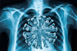 Naujausi duomenys apie omikron atmainą – nurodė, kas kelia nerimą ir kas nuteikia optimistiškai