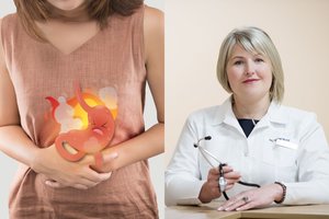 Docentė perspėjo: tarp rėmens gydymui skiriamų vaistų ir COVID-19 infekcijos yra tiesioginis ryšys