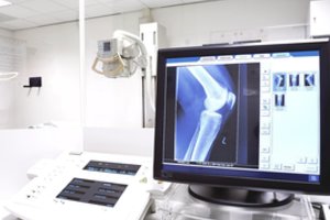 Rentgeno spinduliai: tikrai naudingas išradimas, kurio grėsmės iš pradžių niekas nesuprato