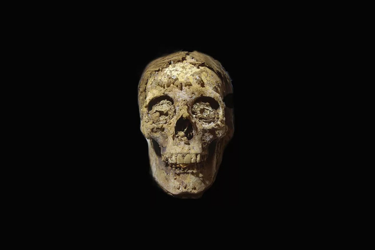  Senovės egiptiečio kaukolė, kurioje matyti aukso folijos liežuvis.