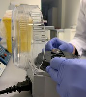 Vyriausybė pritarė projektui dėl palankesnių pagalbinio apvaisinimo sąlygų sudarymo