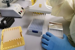 Koronaviruso sekoskaitos ypatumai: ar omikron atmaina jau paplito Lietuvoje?