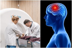 Kaunietės prakeiksmas: dėl skausmo negalėjo nė seilių nuryti – išrovė 3 dantis, kol rado kančios priežastį