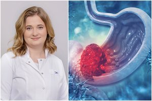 Klastingas vėžys pasireiškia ne iškart: ligą išduoda neįprasti ženklai