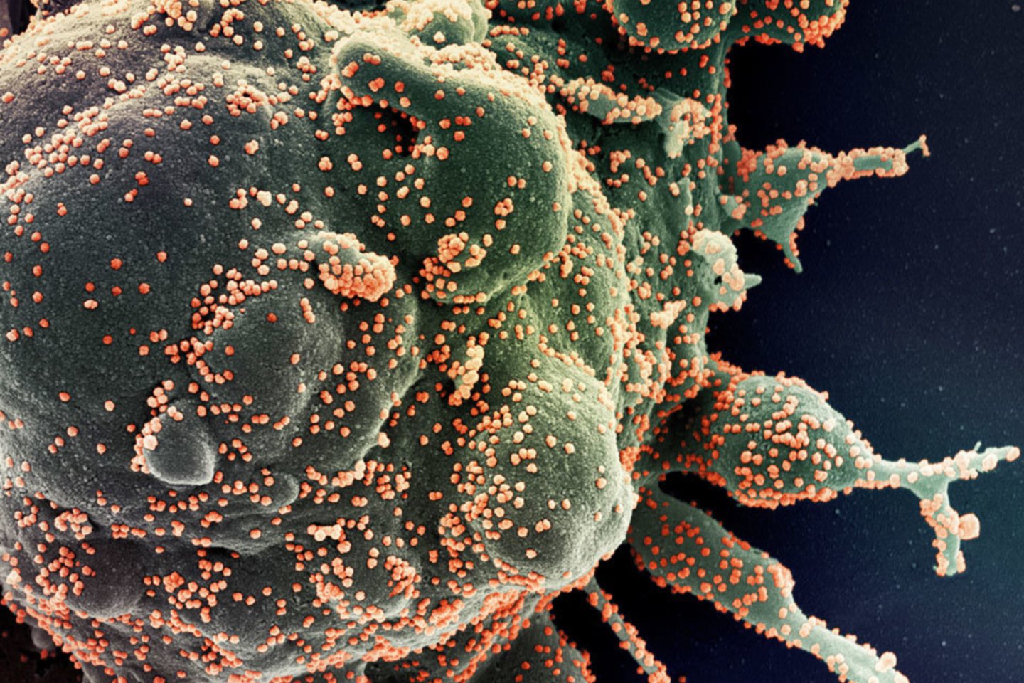 SARS-CoV-2 ant žmogaus ląsteliu paviršiaus (reali eketromikroskopinė nuotrauka).<br>NIAID-RML nuotr.