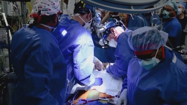 Sėkmingai atlikus gyvūno organo transplantaciją žmogui, medikai neskuba džiūgauti: galimos komplikacijos ateityje