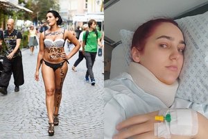 Plius dydžio modelis Vitalija Jonikytė-Bacevičė atsidūrė ligoninėje