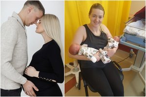 Alytus sulaukė identiškų laimės dvynių: toks komplikuotas nėštumas – retas reiškinys