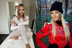 G. Žemaitė neatsidžiaugia plastinės operacijos rezultatu: „Negalėdavau savęs matyti veidrodyje“