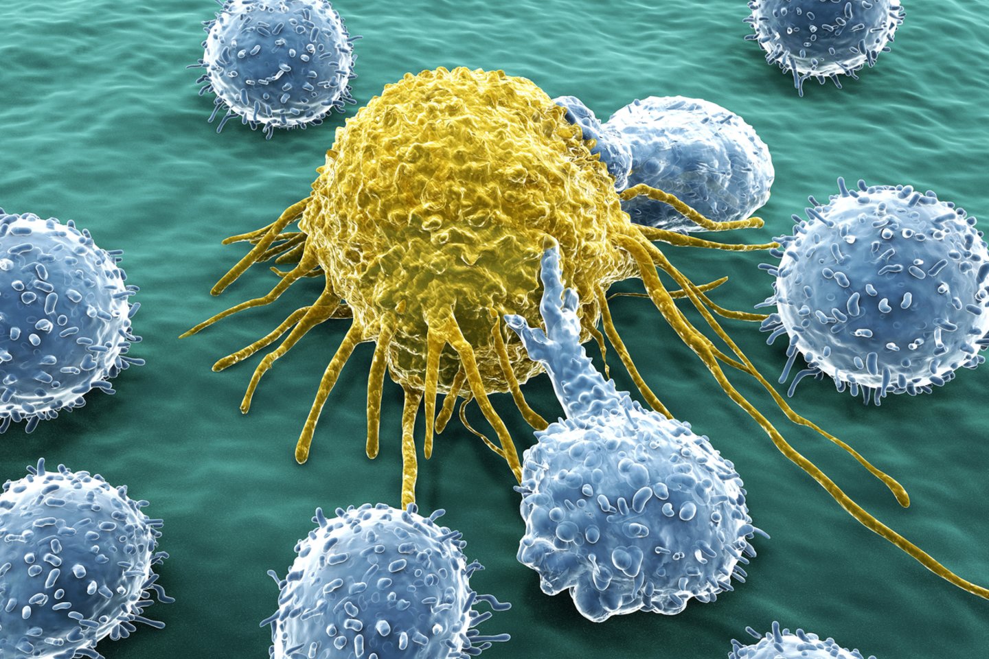 Vėžinės ląstelės.<br>123rf iliustr.