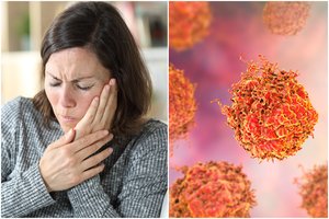 Chirurgas įvardijo burnos vėžio požymius: juos pastebėjus būtina kreiptis pagalbos