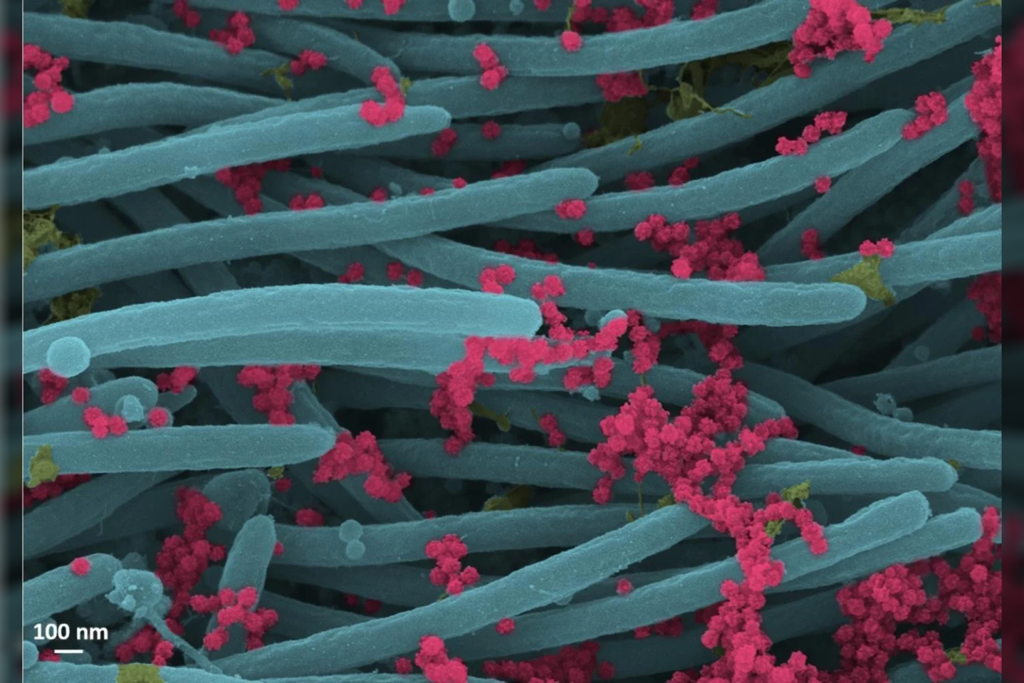  SARS-CoV-2 ant žmogaus ląstelių paviršiaus (reali elektromikroskopinė nuotrauka).<br> NIAID nuotr.