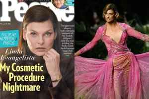 Populiarią grožio procedūrą atlikusi modelis Linda Evangelista ryžosi išpažinčiai apie kančią: „Aš savęs nebeatpažįstu“