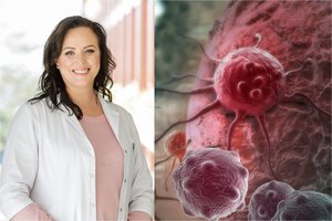 Gydytoja perspėjo dėl klastingo vėžio: arti pusės ligonių miršta per 5 metus, o apsisaugoti tėra keli būdai