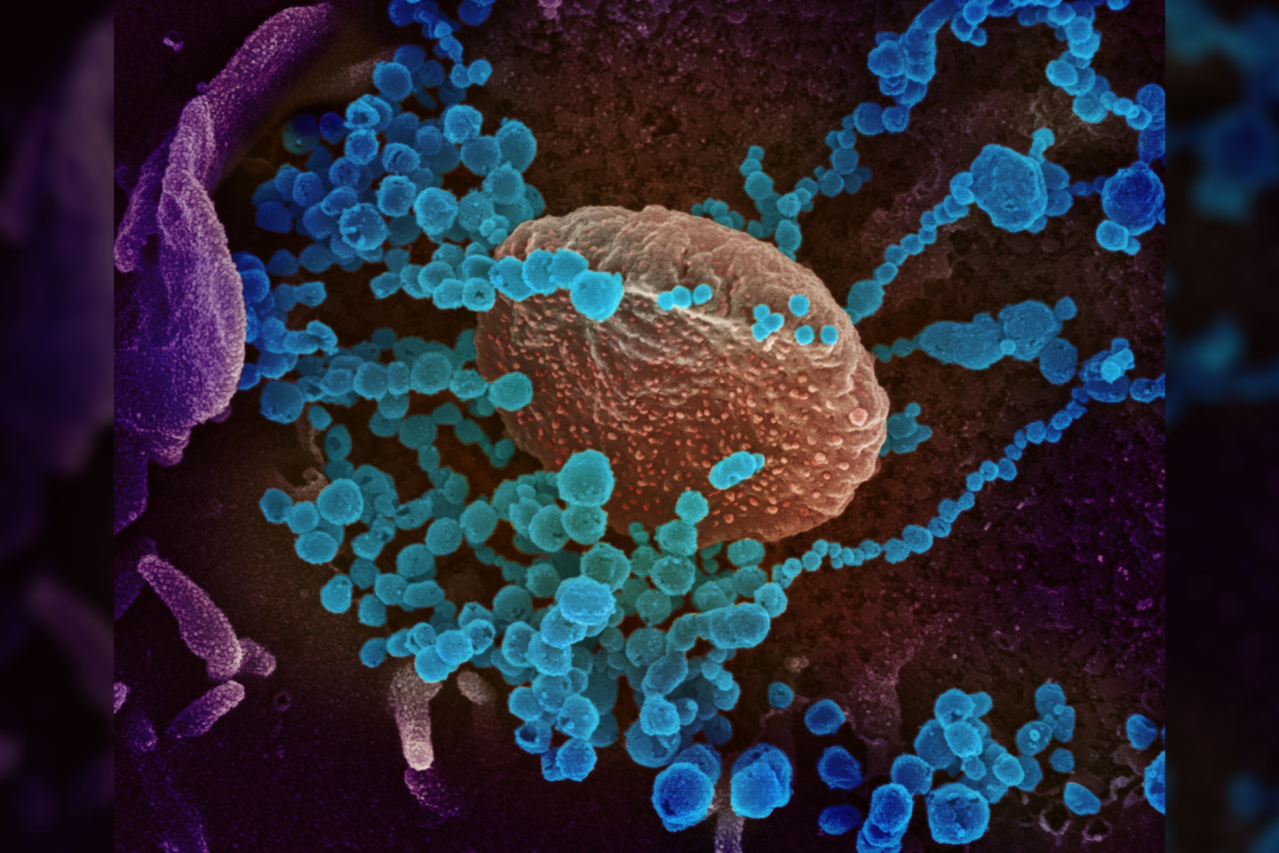  Šioje elektroniniu mikroskopu darytoje nuotraukoje matyti, SARS-CoV-2 (apvalūs mėlynos spalvos objektai) ant laboratorijoje užaugintų ląstelių paviršiaus.<br> NIAID nuotr.