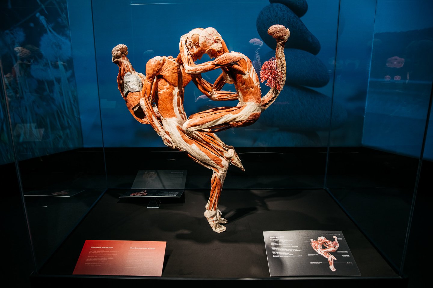  Žmogaus kūno parodą „Body Worlds“ iki kovo 13 d. galima aplankyti Kaune.<br> „Body Worlds“ nuotr.