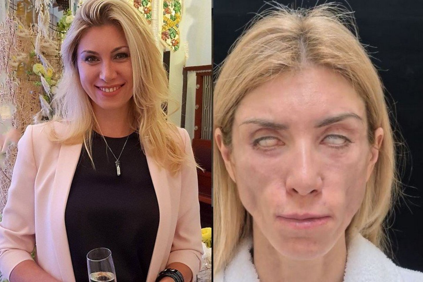  Po grožio procedūrų Julija Tarasevič išgyvena tikrą košmarą.<br> Instagramo nuotr. ir stopkadras.