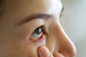 Gydytojai sveikų akių beveik nebemato: davė patarimų, kurie padės išsaugoti gerą regėjimą