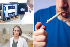 Dėl nedidelio šašiuko vilnietis nė nenorėjo trukdyti medikų – paaiškėjo, kad vyrą reikia skubiai operuoti