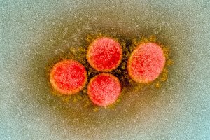 Dar du COVID-19 kilmės tyrimai: daugiau įrodymų, iš kur atsirado virusas