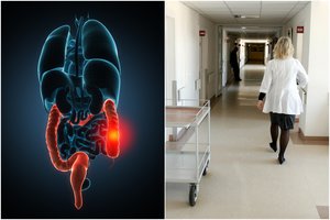 Į vėžį išdavusį ženklą ranka numojusi Danguolė nori įspėti kitus – nekartokite mano klaidos