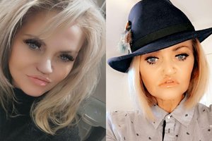 Kvaišalais išvaizdą sudarkiusi Danniella Westbrook negali atsidžiaugti pokyčiais