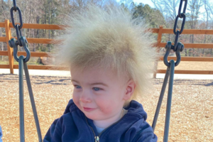 Po įspūdinga berniuko šukuosena slepiasi retas sindromas – žinoma vos 100 šios ligos atvejų