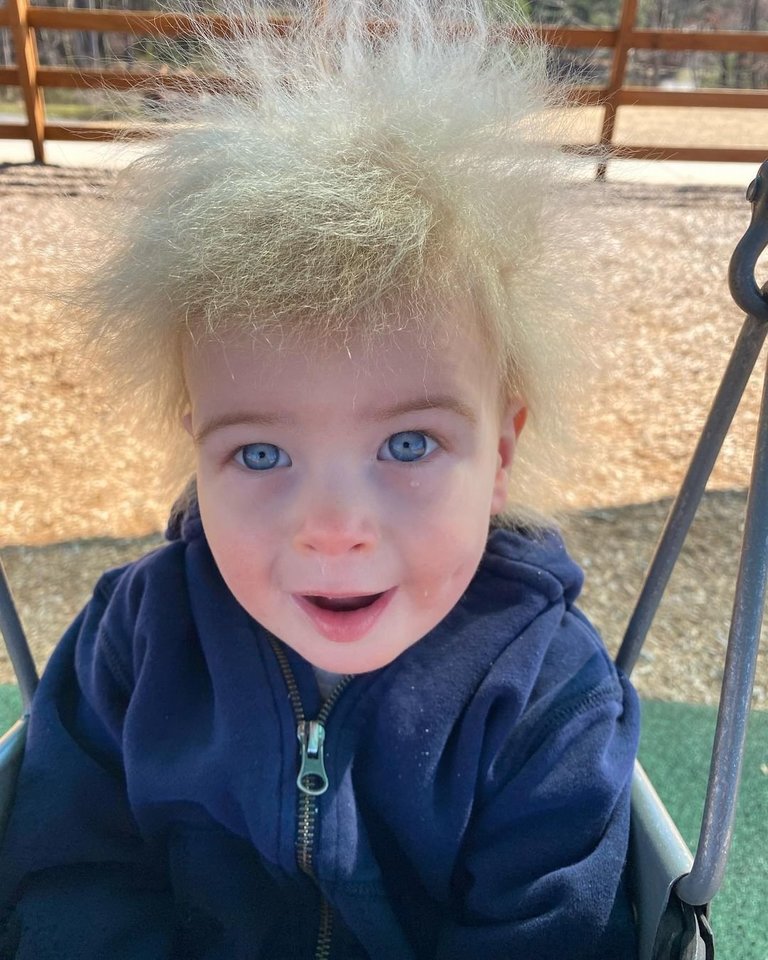  Įspūdingą berniuko šukuoseną lėmė neiššukuojamų plaukų sindromas.<br> Katelyn Samples nuotr.