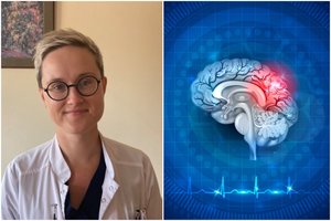 Gydytoja įvardijo pirmuosius insulto požymius: juos įsiminti nesunku, o laiku atpažinti – gyvybiškai svarbu