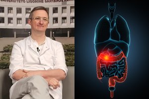 Nuožmaus vėžio pirmieji ženklai pasirodo anksti: pasakė, kokie simptomai išduoda ligą