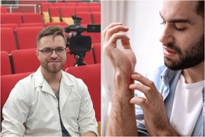 Gydytojas – apie tai, kada dėl alerginės reakcijos reikia kviesti medikus ir kaip nustatoma lėtinė alergija