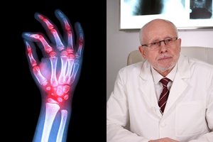 Artritas: profesorius įvardijo sąnarių ligos atsiradimo priežastis ir davė gerą patarimą