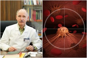 Nebylus vėžys nepalieka beveik jokių šansų išgyventi – medikai lietuviams siūlo naują gelbėjimosi ratą