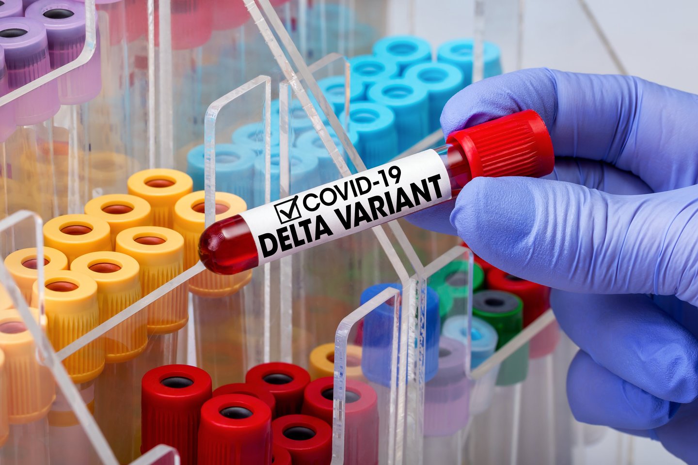  Atlikus viso genomo sekoskaitą nustatyta, kad moteris buvo užsikrėtusi dviem skirtingomis viruso atmainomis – gruodžio mėnesį Delta, o sausio mėnesį – Omikron atmaina.<br>  123rf nuotr.