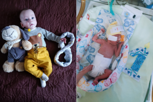 26 savaičių gimęs Hubertas sulaukęs net ir 8 mėnesių vis dar mokosi kvėpuoti